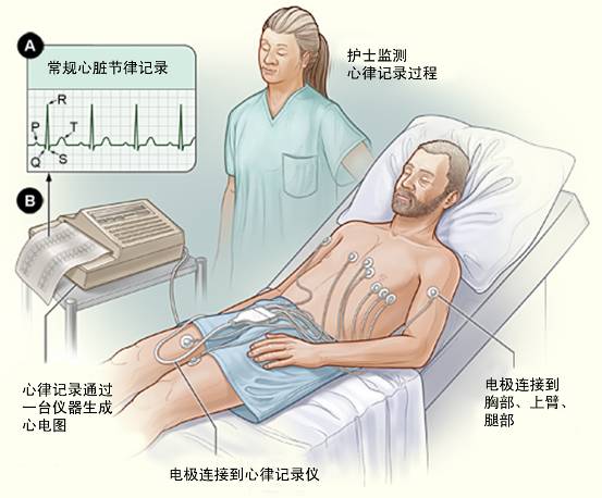 冠心病需要做哪些檢查？(圖1)
