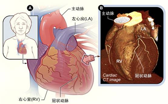 冠心病需要做哪些檢查？(圖2)