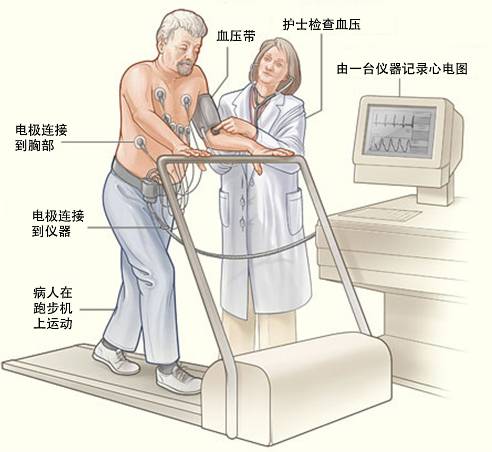 冠心病需要做哪些檢查？(圖3)